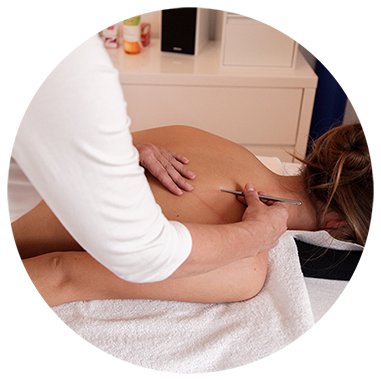 Akupunktur Massage